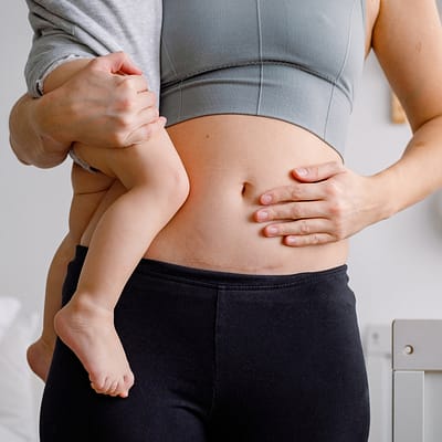 Postpartumhoiva – Sektioarven hoito (30 min)